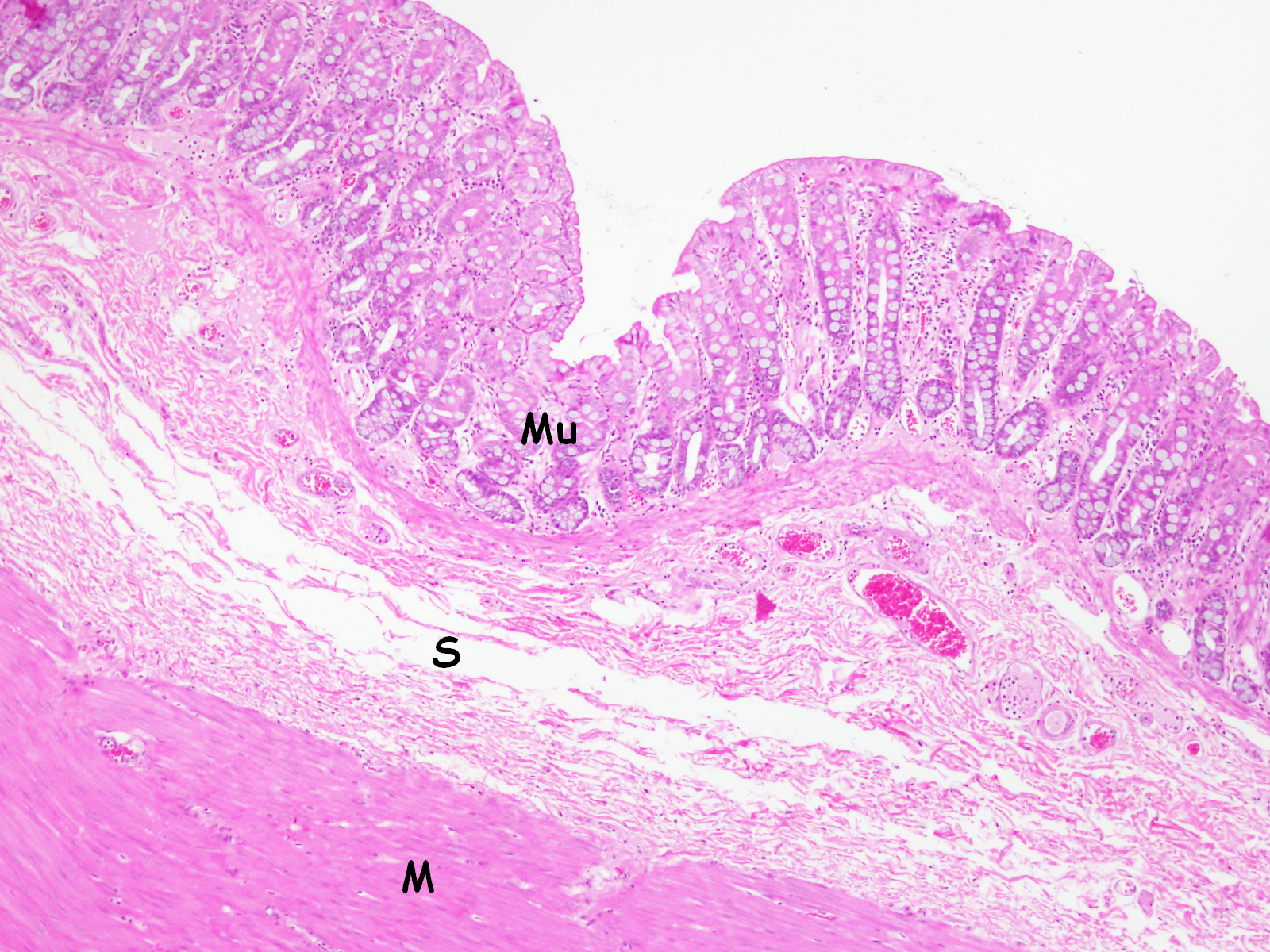 Histologia Do Intestino Grosso