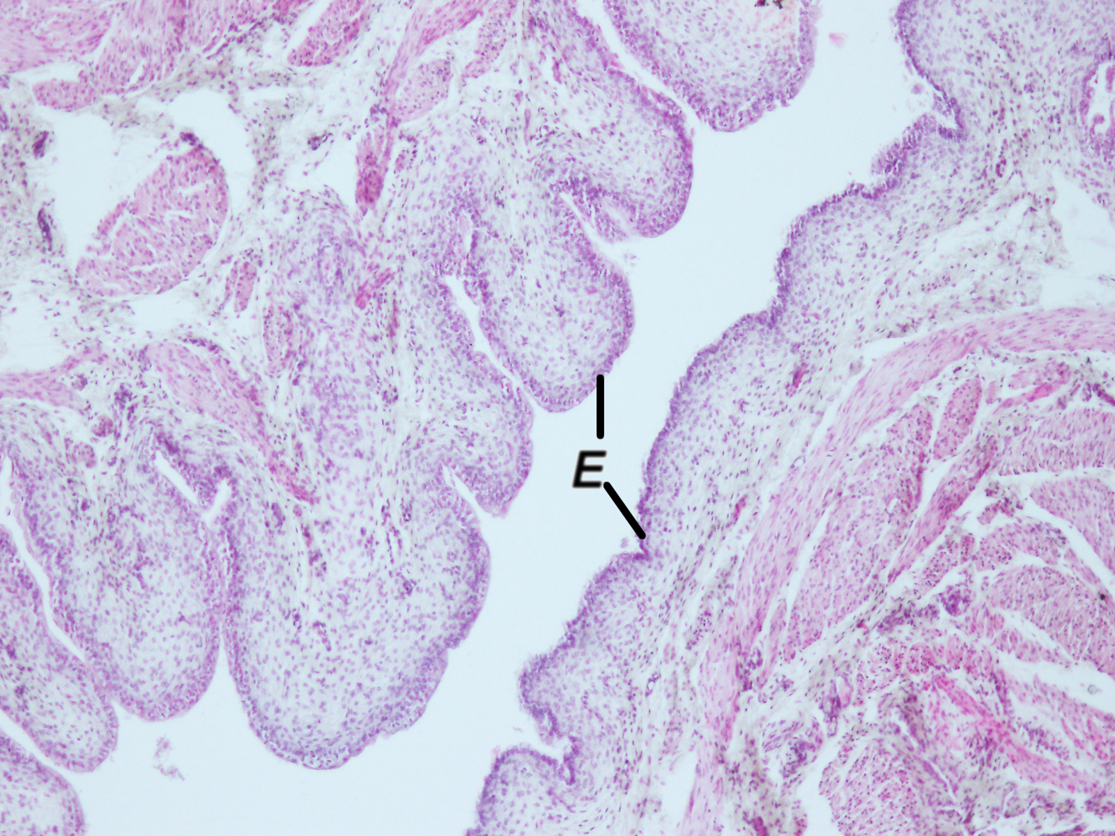 histología de la uretra esponjosa